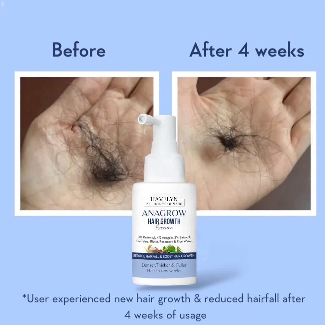 ANAGROW Hair Growth Serum