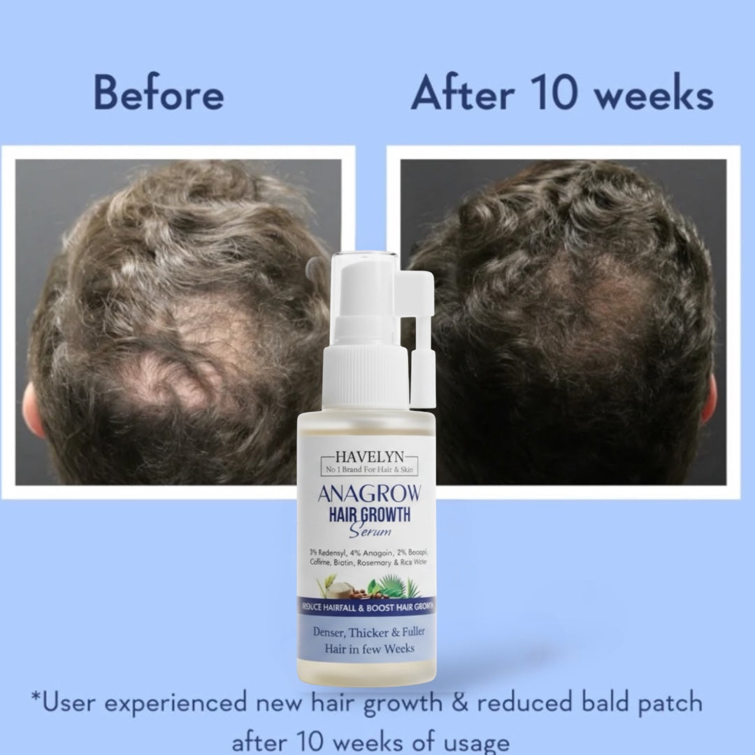 Anagrow Hair Growth Serum