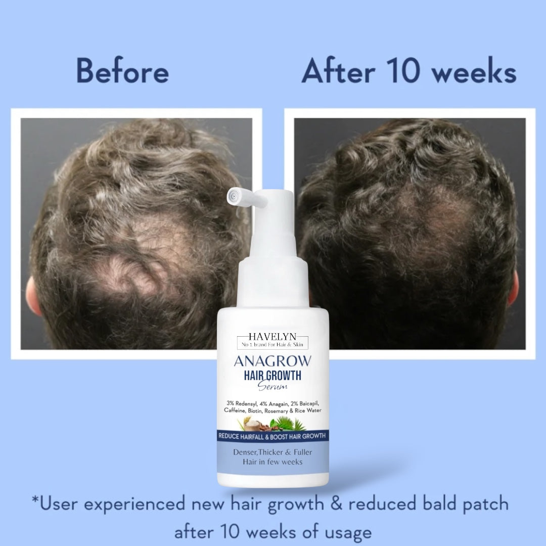 ANAGROW Hair Growth Serum