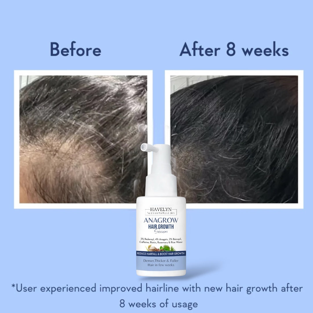 ANAGROW Hair Growth Serum